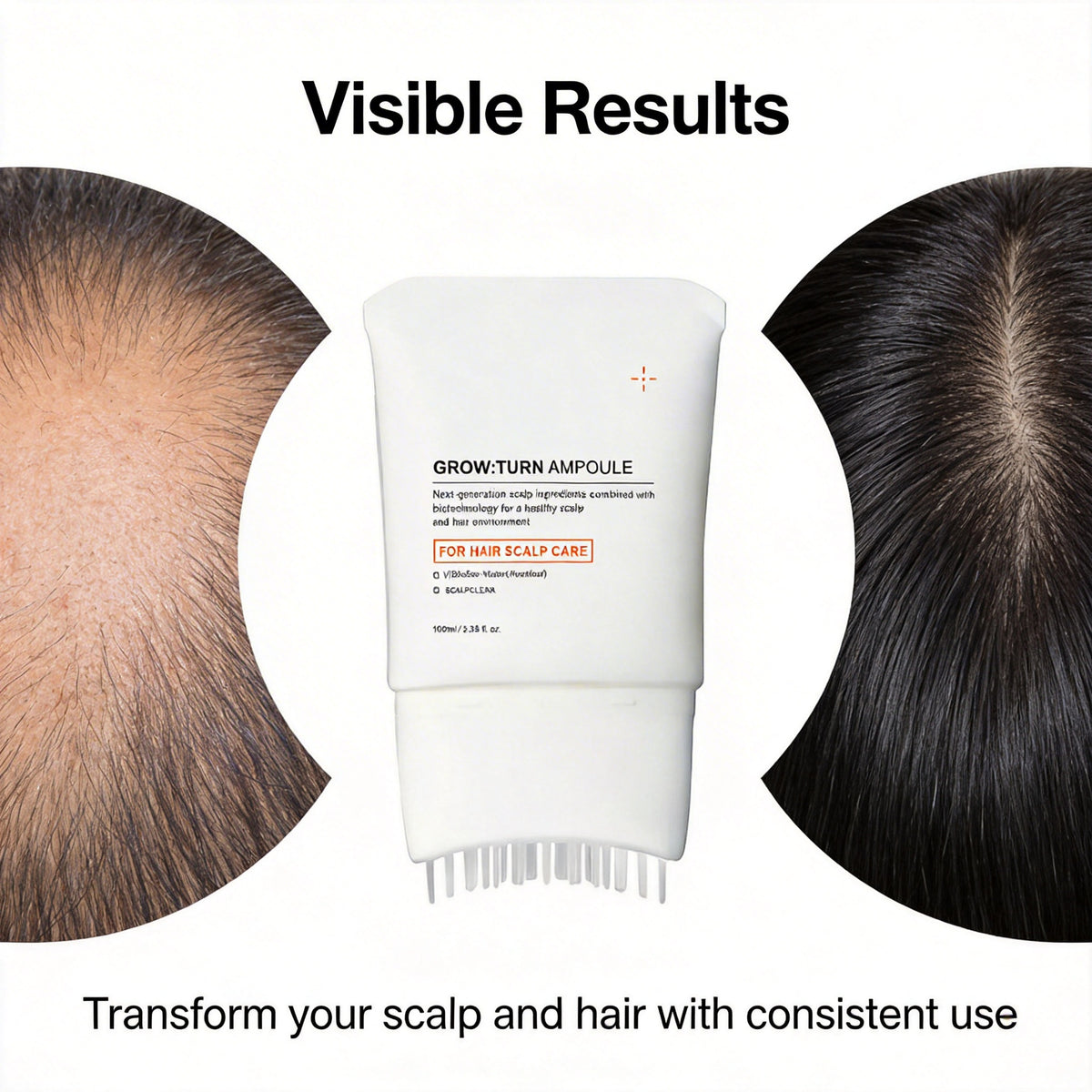 Hair Growth Serum with Massage Brush Head – Scalp Nourishing & Follicle Care Treatment (100ml) - ElevateHealthTech