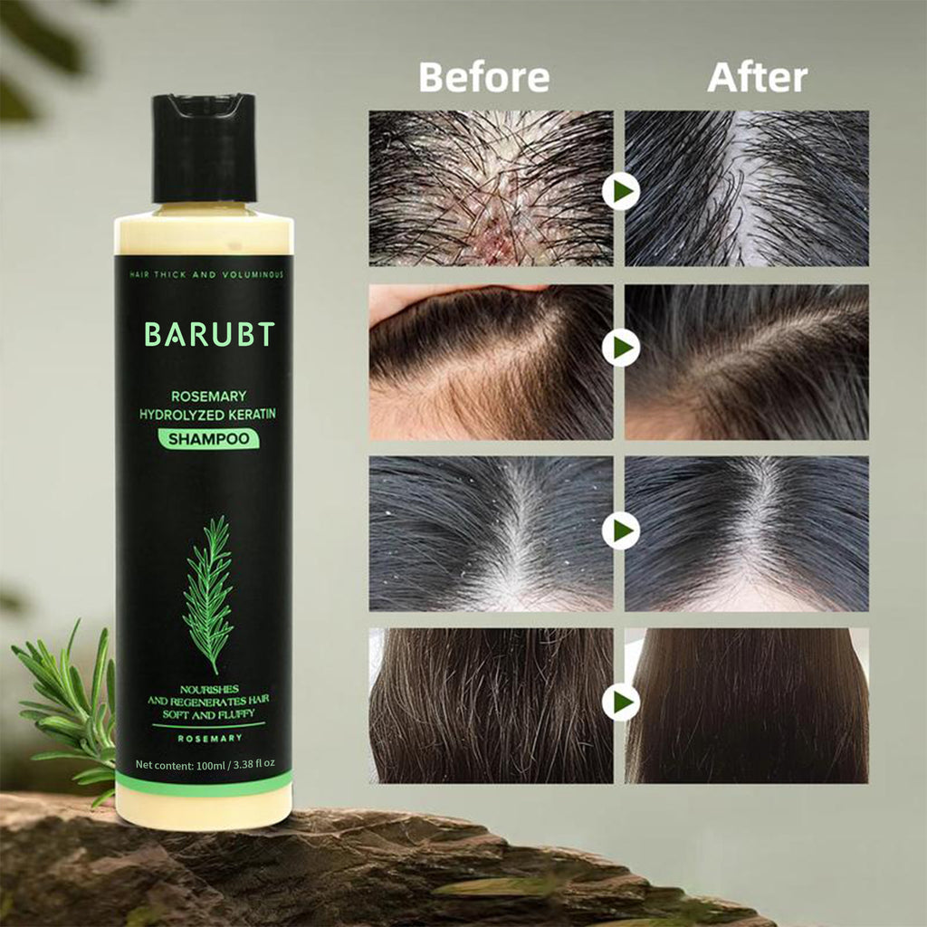 Rosemary Revitalizing Shampoo – Scalp Cleansing, Anti-Dandruff & Hydrating Hair Care - ElevateHealthTech