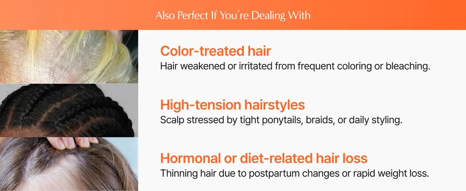 Hair Growth Serum with Massage Brush Head – Scalp Nourishing & Follicle Care Treatment (100ml) - ElevateHealthTech