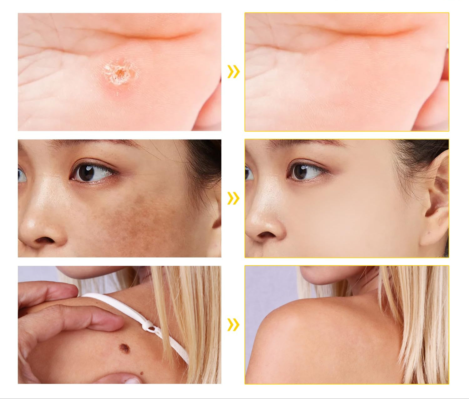 Bee Venom Skin Care Cream – Deep Hydration & Skin-Smoothing Moisturizer for All Skin Types - ElevateHealthTech