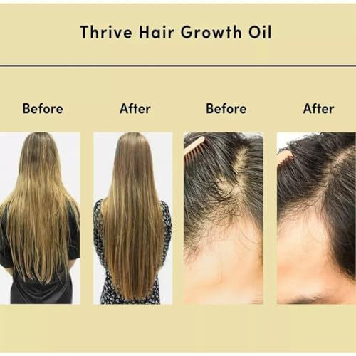 Hair Care Essential Oil - ElevateHealthTech