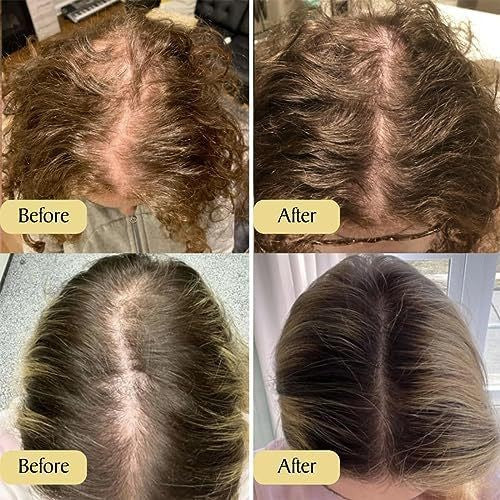 Hair Care Essential Oil - ElevateHealthTech