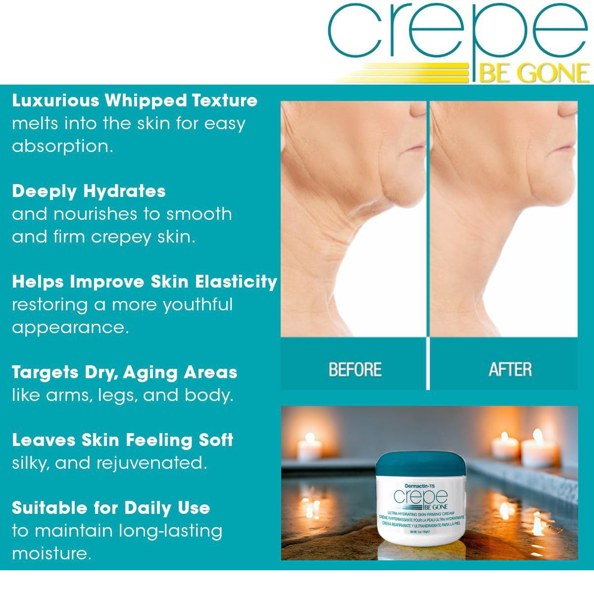Body moisturizer - ElevateHealthTech