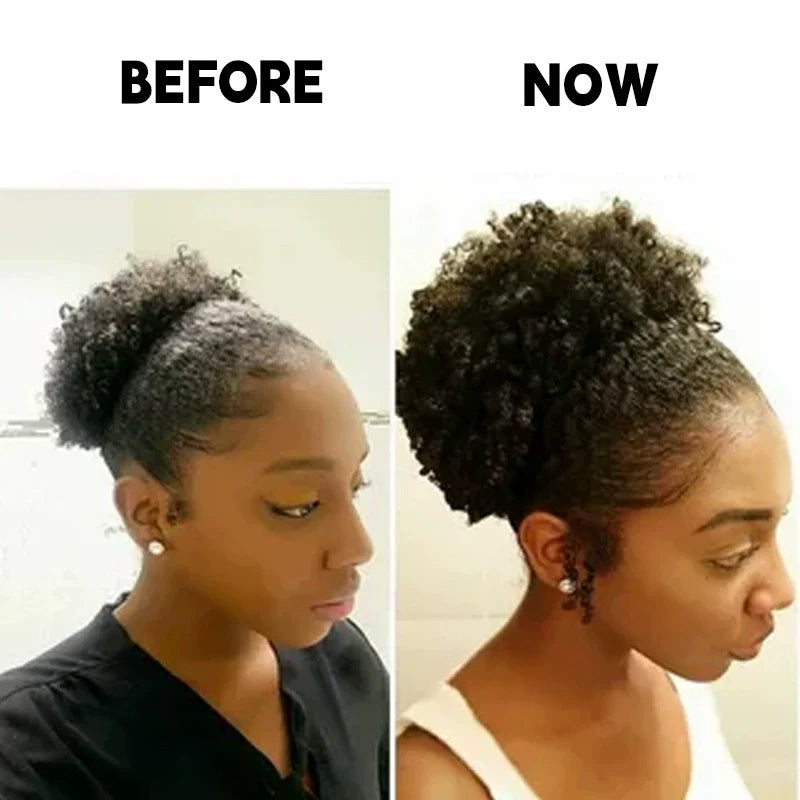 Scalp Stimulator – Hair Growth Oil for Stronger, Healthier Hair - ElevateHealthTech