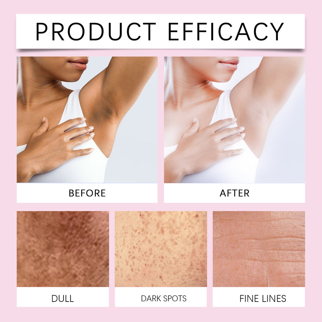 Body Dark Spot Correcting Moisturizing Cream - ElevateHealthTech