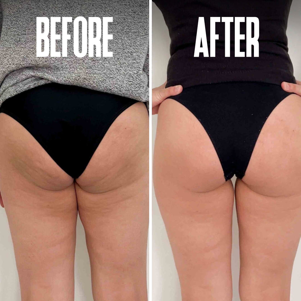 Brazilian Body Firming Cream – Hydrating & Toning Formula for Smooth Skin - ElevateHealthTech