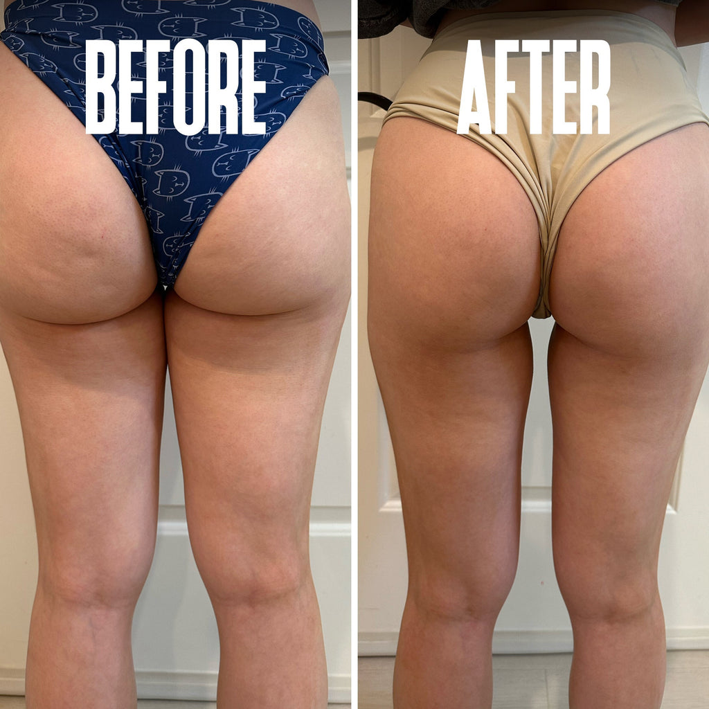Brazilian Body Firming Cream – Hydrating & Toning Formula for Smooth Skin - ElevateHealthTech