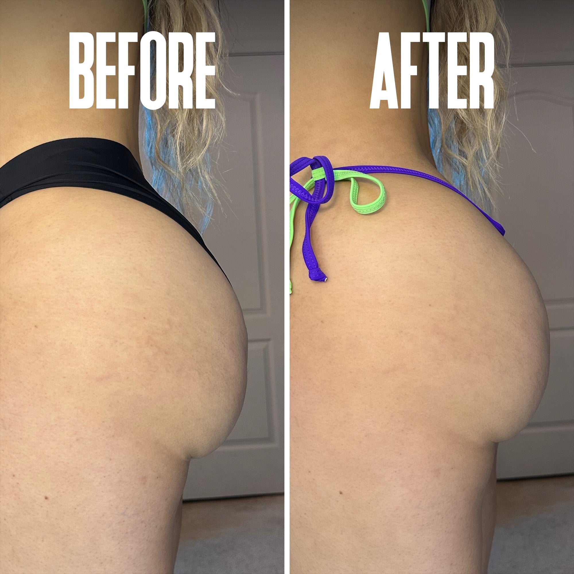 Brazilian Body Firming Cream – Hydrating & Toning Formula for Smooth Skin - ElevateHealthTech