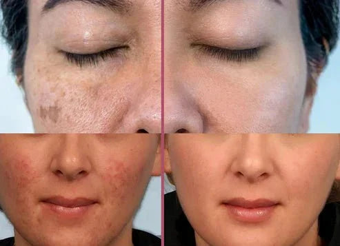 Turmeric Kojic Acid Cleansing Pads - ElevateHealthTech