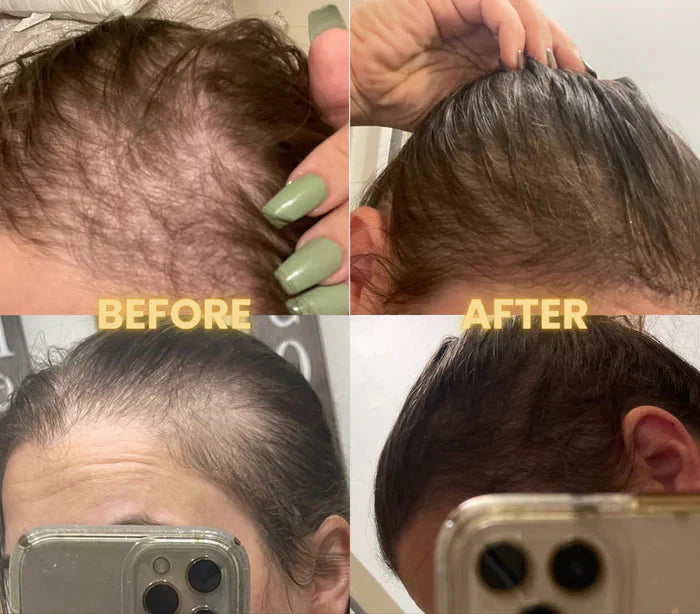 Scalp Stimulator – Hair Growth Oil for Stronger, Healthier Hair - ElevateHealthTech
